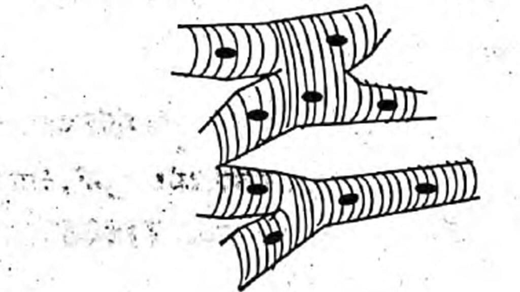 Q-3